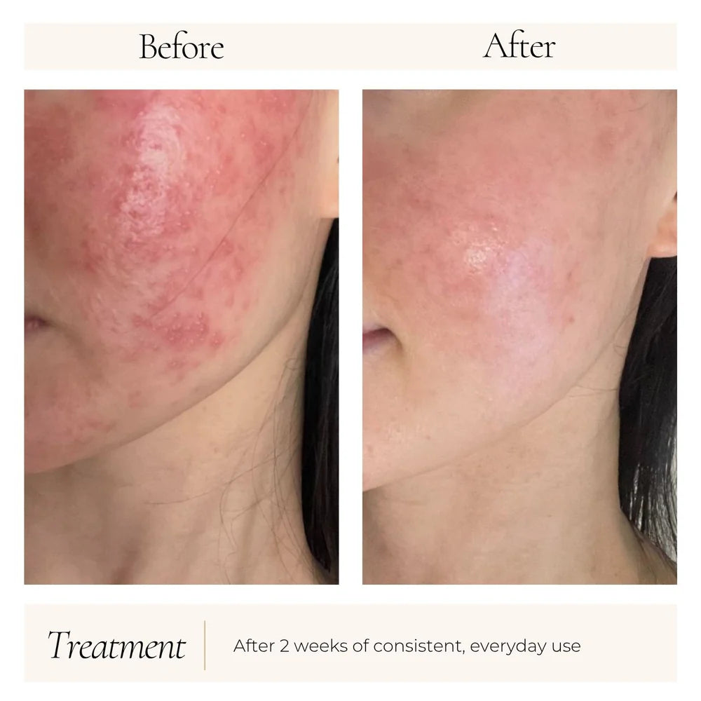 Iso-Cell Recovery Solution